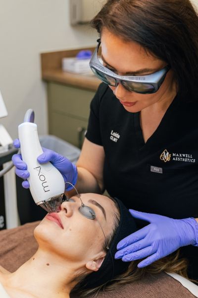 MedSpa Laser Treatment Image